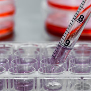 The Grand Challenges of Cancer Research
